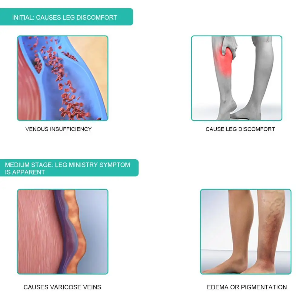1Pair Medical Compression Sock - огляд і ціна Compression Sleeve Calf