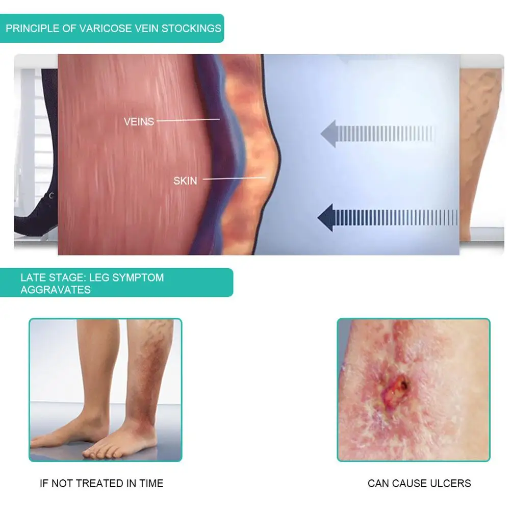 1Pair Medical Compression Sock - огляд і ціна Compression Sleeve Calf